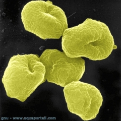 archee-archeobacterie-sulfolobus.jpg